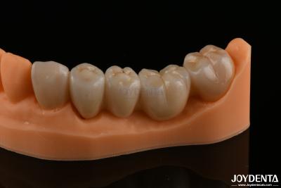 China Precision Dental Restorations Full Zirconia High Flexural Strength Natural Color for sale