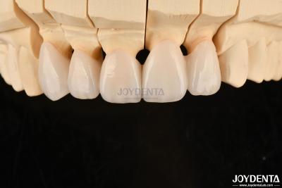 China Coronas y puentes dentales de zirconia de capas altamente personalizables Solución duradera en venta