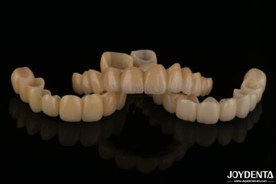 China Natural Looking Porcelain Layered Zirconia Bridges Wear Resistance High Biocompatibility for sale