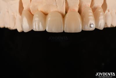 China CAD / CAM Milling Dental Layered Zirconia For Single Crowns 0.3-0.5mm Layer Thickness for sale