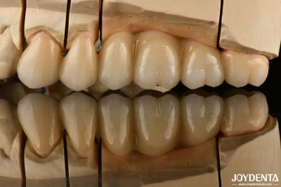 China Natural Looking Multilayer Full Zirconia For Dental Restorations Ultra Translucent for sale