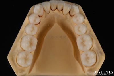 China 3D Multi Layer Dental Full Zirconia Chipping Resistance Natural Tooth Structure for sale