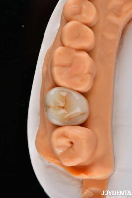 China Dental Multilayer Full Zirconia Crowns And Bridges High Translucent Natural Looking for sale