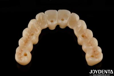 Cina Ponte ibrida in zirconia ad alta flessibilità con base in titanio in vendita