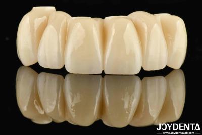 China Tandheelkundige restauratie Ti-Base Zirconia Hybride Bridge Natuurlijk uitziende Precise Fit Te koop