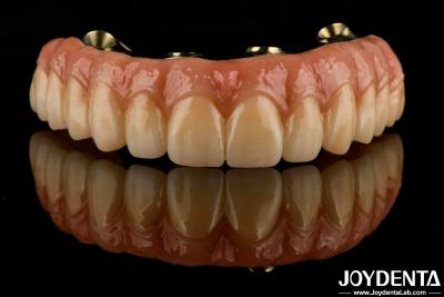 China Dental Ti-Bar Hybrid Zirconia Bridge Excellent Strength Restores Chewing Function for sale