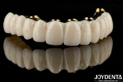 China Smooth Hybrid Zirconia Implant Bridge Restoring Chewing Function Custom Made for sale