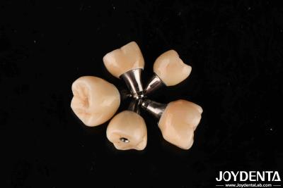 China Schroefretentie Titanium abutments Interne hexverbinding voor tandheelkundige implantaten Te koop