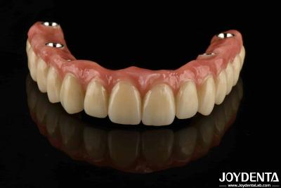 China Puente híbrido dental de titanio personalizado Resistencia a la corrosión ajustable en venta