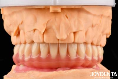 China Natural Looking Acrylic Denture Finish High Biocompatibility With Tooth Arrangement Technology for sale