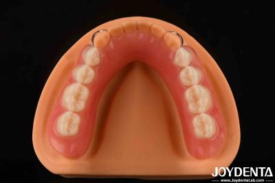 China Personalização Prótese dentária acrílica acabamento leve Alta elasticidade à venda