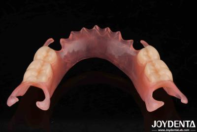 China Comfortable Fit Dental Flexible Denture Finish With High Stealth Diverse Materials for sale