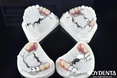 China Elaborate Technology Framework Set Up Teeth Finish for Stable Oral Structure for sale