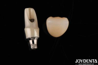 China Circonia Abutments custom e barras Restaurações dentárias para anatomia individual do paciente à venda