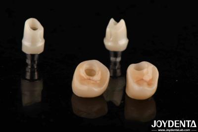 China Abutments Dentários de Zircônia de Cor Prateada Para Implantes Diâmetro Personalizavel à venda