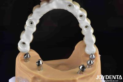 Cina Soluzione dentale resistente alle fratture a base di zirconia ibrida ad alta resistenza in vendita