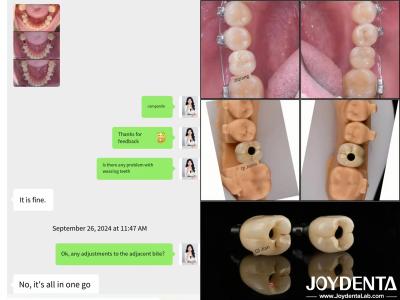 Cina Impianti dentali ad arco completo di lunga durata Lungozza dell'impianto endosseo 10 mm-16 mm in vendita