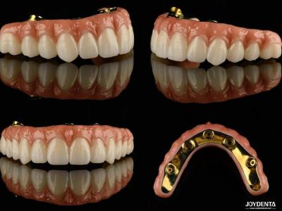 China Ti Bar Zirconia Hybrid Implant Bridges High Translucency For Dental Prosthesis for sale