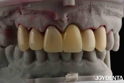 Chine CAD CAM Processing Dental PMMA Material Multilayer Design Pour les transitions naturelles de l'ombre à vendre