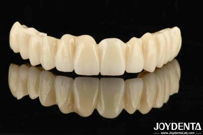 China Desenho dentário de PMMA multicamadas com gradiente sem costura para transições naturais de sombra à venda