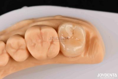 China Alta resistencia Emax Inlay Onlay A2 Color Duradera para la restauración de dientes dañados en venta