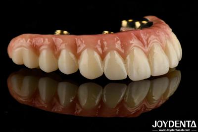 China Custom-made For Each Patient Ti-Bar Zirconia Hybrid Bridge For Long-lasting Dental Prosthesis for sale