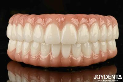 China High Biocompatibility Ti-Bar Zirconia Hybrid Bridge For Precise Fit And Missing Teeth Replacement for sale