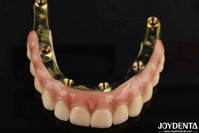 China Dental Prosthesis Ti-Bar Zirconia Hybrid Bridge With High Biocompatibility Standards for sale