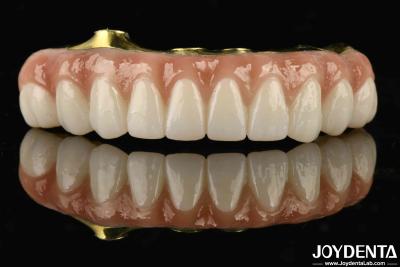 China Titanium And Zirconia Comfort Comfortable To Wear Ti-Bar Zirconia Hybrid Bridge For Replacement Of Missing Teeth for sale