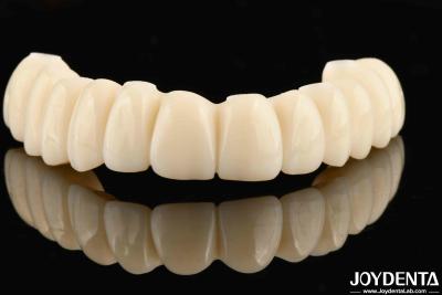 China Customizable Ti-Base Zirconia Hybrid Bridge With Excellent Durability And Good Biocompatibility for sale