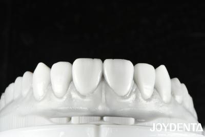 China Cera Dental de Cor Natural Solução versátil para restauração de dentes únicos ou múltiplos à venda