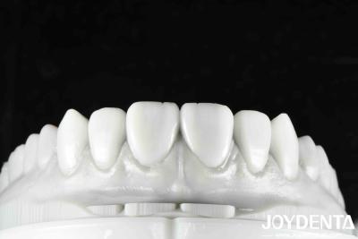 China Flexible Denture Finish Revolutionize Your Dental Practice With Natural Tooth Morphology Tooth Arrangement Technology And Lightweight Property for sale