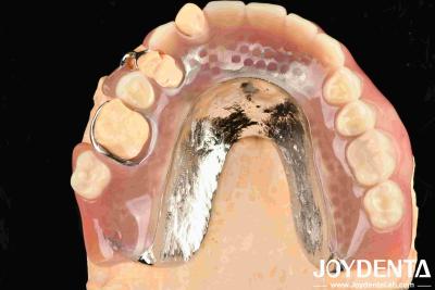 China Beautiful And Harmonious Framework Set UP Teeth Finish For Dental Treatment Rooms for sale