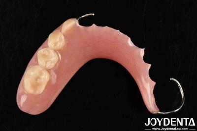 China Elaborate Technology For Stable Oral Structure Framework Set Up Teeth Finish In Dental Application for sale