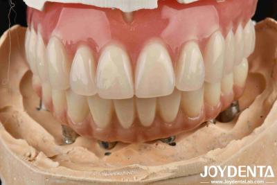 China Good Elasticity Dental Acrylic Denture Finish With Tooth Arrangement Technology for sale