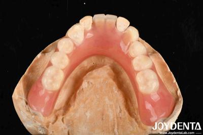 China Lightweight Good Biocompatibility Acrylic Denture Finish Personalized Customization In Medical Equipment for sale