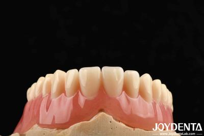 China Good Elasticity Acrylic Denture Finish For Lightweight Personalized Customization And Customized Design for sale