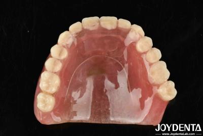 China Material de resina de buena elasticidad que mejora el rendimiento y la durabilidad de la prótesis dental acrílica para productos en venta