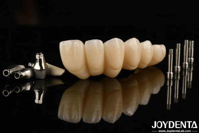 China Experimenta la estética definitiva con una corona y puente de implantes dentales estéticos. en venta