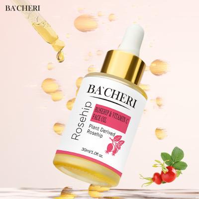 China Private Label Whitening Brightening Repairing Skin Care Roseship Organic Vitamin C Oil For Face for sale