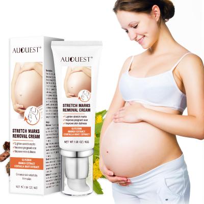 China Skin Revitalizer Body Skin Care Skin Repair Remove Pregnancy Scar Removal Clear Stretch Mark Cream for sale