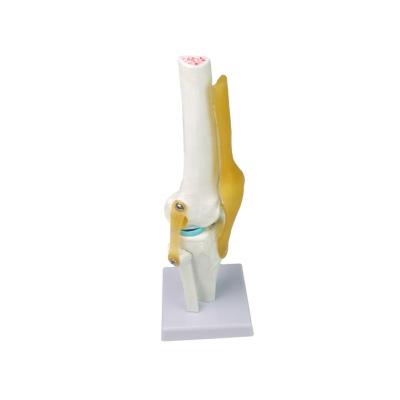 China Medical School Anatomical Musculoskeletal Human Skeletal Knee Joint Model with Ligament, PVC Bone Model for sale