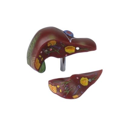 China Medical Faculty 2 Plastic Anatomical Human Liver Model Detachable Parts, Liver Pathological Model for sale