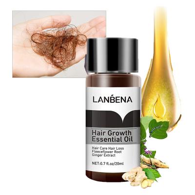 China Loss Prevention Organic Natural Herbal Instant Hair Grow Spray Hair Growth Women Wholesale Scalp Therapeutic for sale