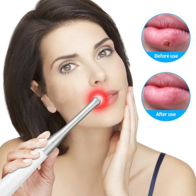 China Handheld Infrared Physiotherapy Equipment 660nm 850nm Low EMF Light Oral Instrument for sale