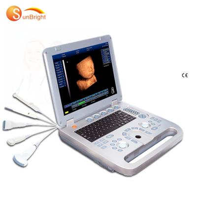 China OB Ultrasound China Portable Ultrasound Vet Made 3D Color Portable Ultrasound Machine for sale