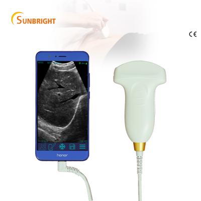 China OB/GYN USB Convex Ultrasound Probe for Laptop and Smartphone 3d USB Ultrasound Probe Pocket Probe for sale