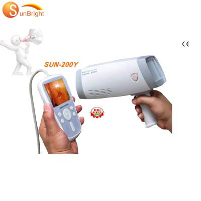 China Metal Colposcope SUN-200Y Electronic Handheld Trolley Hospital Digital Video Colposcope for sale