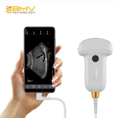 China Hospital factory direct-sale USB convex probe portable abdominal ultrasound for sale