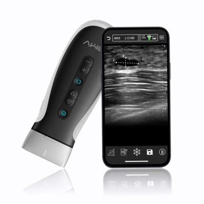 China 2021 New Arrival Wireless Portable Color Doppler Ultrasound Scanner Wireless Probe Suitable for Human and Animals for sale